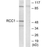 Western blot analysis of extracts from HepG2 cells, using Retinoic Acid Receptor β antibody.Rabbit anti-Human RARB Polyclonal Antibody