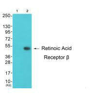 Western blot analysis of extracts from K562 cells (Lane 2), using Retinoic Acid Receptor β antiobdy. The lane on the left is treated with synthesized peptide.Rabbit anti-Human RARB Polyclonal Antibody