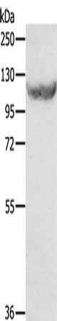 Gel: 8%SDS-PAGE, Lysate: 40 μg, Lane: HT29 cells, Primary antibody: COQ3 Antibody(EIF2AK3 Antibody) at dilution 1/500, Secondary antibody: Goat anti rabbit IgG at 1/8000 dilution, Exposure time: 1 minuteRabbit anti-Human COQ3 Polyclonal Antibody