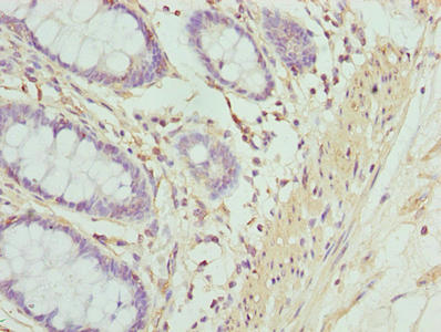 Immunohistochemistry of paraffin-embedded human colon tissue using ACTG2 Antibody at dilution of 1:100