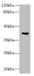 Western blot  | All lanes: ACTG2 antibody at 3µg/ml + CEM whole cell lysate  | Secondary  | Goat polyclonal to rabbit IgG at 1/10000 dilution  | Predicted band size: 42, 38 kDa  | Observed band size: 42 kDa