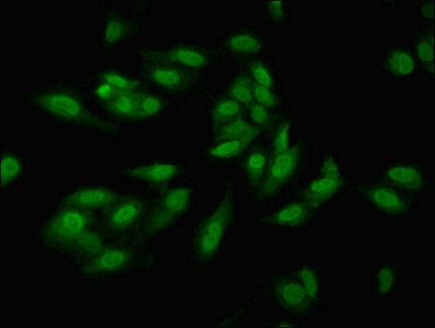 Immunofluorescent analysis of Hela cells using HIF1A Antibody at dilution of 1:100 and Alexa Fluor 488-congugated AffiniPure Goat Anti-Rabbit IgG(H+L)Rabbit anti-Human HIF1A Polyclonal Antibody