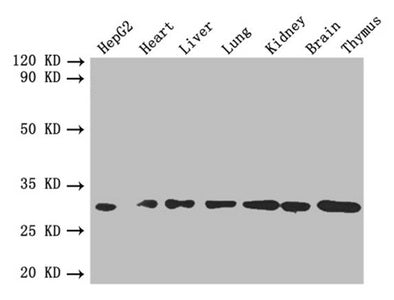 Western blot  | All lanes: FGF2 antibody at 4µg/ml  | Lane 1: HepG2 whole cell lysate  | Lane 2: Mouse heart tissue  | Lane 3: Mouse liver tissue  | Lane 4: Mouse lung tissue  | Lane 5: Mouse kidney tissue  | Lane 6: Mouse brain tissue  | Lane 7: Mouse thymus tissue  | Secondary  | Goat polyclonal to rabbit IgG at 1/10000 dilution  | Predicted band size: 31, 23, 18, 22 kDa  | Observed band size: 31 kDaRabbit anti-Human FGF2 Polyclonal Antibody