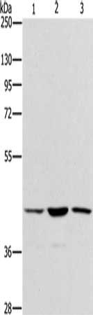Gel: 8%SDS-PAGE, Lysate: 40 μg, Lane 1-3: Hela cells, K562 cells, hepG2 cells, Primary antibody: IBSP Antibody(IBSP Antibody) at dilution 1/350, Secondary antibody: Goat anti rabbit IgG at 1/8000 dilution, Exposure time: 10 secondsRabbit anti-Human IBSP Polyclonal Antibody