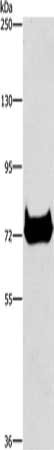 Gel: 6%SDS-PAGE, Lysate: 40 μg, Lane: Mouse pancreas tissue, Primary antibody: CEL Antibody(CEL Antibody) at dilution 1/500, Secondary antibody: Goat anti rabbit IgG at 1/8000 dilution, Exposure time: 20 secondsRabbit anti-Human CEL Polyclonal Antibody