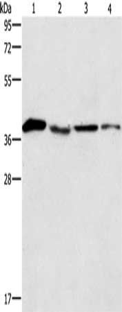 Gel: 12%SDS-PAGE, Lysate: 40 μg, Lane 1-4: Human placenta tissue, NIH/3T3 cells, Raji cells, hepG2 cells, Primary antibody: BCAT2 Antibody(BCAT2 Antibody) at dilution 1/250, Secondary antibody: Goat anti rabbit IgG at 1/8000 dilution, Exposure time: 5 seconds