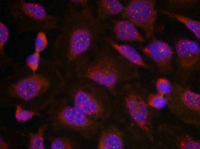 Immunofluorescence staining of methanol-fixed Hela cells using BCL-2(Ab-70) Antibody.