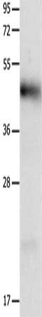 Gel: 12%SDS-PAGE, Lysate: 40 μg, Lane: Human liver cancer tissue, Primary antibody: LRP1 Antibody(LRP1  Antibody) at dilution 1/1250, Secondary antibody: Goat anti rabbit IgG at 1/8000 dilution, Exposure time: 40 seconds