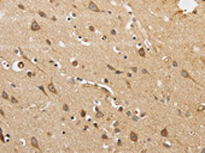 The image on the left is immunohistochemistry of paraffin-embedded Human brain  tissue using ARF6 Antibody(ARF6 Antibody) at dilution 1/30, on the right is treated with synthetic peptide. (Original magnification: ×200)Rabbit anti-Human ARF6 Polyclonal Antibody