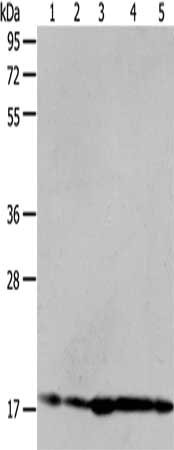 Gel: 8%SDS-PAGE, Lysate: 40 μg, Lane 1-5: Hela cells, 293T cells, mouse liver tissue, A431 cells, MCF7 cells, Primary antibody: ARF6 Antibody(ARF6 Antibody) at dilution 1/450, Secondary antibody: Goat anti rabbit IgG at 1/8000 dilution, Exposure time: 40 secondsRabbit anti-Human ARF6 Polyclonal Antibody