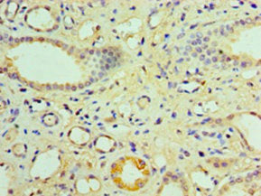Immunohistochemistry of paraffin-embedded human kidney tissue using the antibody at dilution of 1:100Rabbit anti-Human NR1I3 Polyclonal Antibody