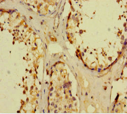 Immunohistochemistry of paraffin-embedded human testis tissue using NR1I3 Antibody at dilution of 1:100Rabbit anti-Human NR1I3 Polyclonal Antibody