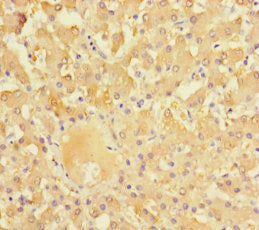 Immunohistochemistry of paraffin-embedded human liver tissue using NR1I3 Antibody at dilution of 1:100Rabbit anti-Human NR1I3 Polyclonal Antibody