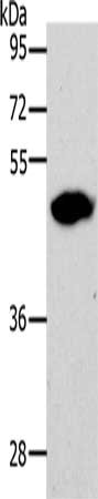 Gel: 10%SDS-PAGE, Lysate: 60 μg, Lane: 293T cells, Primary antibody: LOX Antibody(LOX Antibody) at dilution 1/500, Secondary antibody: Goat anti rabbit IgG at 1/8000 dilution, Exposure time: 1 minute