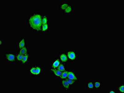 Immunofluorescent analysis of PC-3 cells cells using CDH12 Antibody at dilution of 1:100 and Alexa Fluor 488-congugated AffiniPure Goat Anti-Rabbit IgG(H+L)Rabbit anti-Human CDH12 Polyclonal Antibody