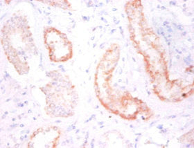 Immunohistochemistry of paraffin-embedded human kidney tissue using CDH12 Antibody at dilution of 1:50Rabbit anti-Human CDH12 Polyclonal Antibody