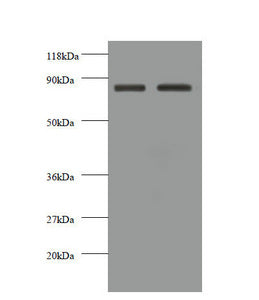 Western blot  | All lanes: CDH12 antibody at 2µg/ml  | Lane 1: EC109 whole cell lysate  | Lane 2: 293T whole cell lysate  | Secondary  | Goat polyclonal to rabbit IgG at 1/10000 dilution  | Predicted band size: 89, 85 kDa  | Observed band size: 85 kDaRabbit anti-Human CDH12 Polyclonal Antibody