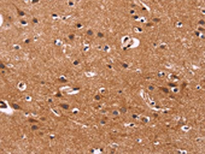 The image on the left is immunohistochemistry of paraffin-embedded Human brain  tissue using ARL4A Antibody(ARL4A Antibody) at dilution 1/50, on the right is treated with fusion protein. (Original magnification: ×200)Rabbit anti-Human ARL4A Polyclonal Antibody