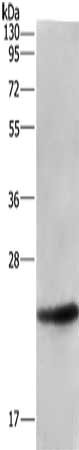 Gel: 10%SDS-PAGE, Lysate: 40 μg, Lane: Human fetal liver tissue, Primary antibody: ARL4A Antibody(ARL4A Antibody) at dilution 1/533, Secondary antibody: Goat anti rabbit IgG at 1/8000 dilution, Exposure time: 30 secondsRabbit anti-Human ARL4A Polyclonal Antibody