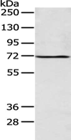 Gel: 8%SDS-PAGE, Lysate: 40 μg, Lane: Human fetal liver tissue, Primary antibody: ALG9 Antibody(ALG9 Antibody) at dilution 1/200 dilution, Secondary antibody: Goat anti rabbit IgG at 1/8000 dilution, Exposure time: 1 minuteRabbit anti-Human ALG9 Polyclonal Antibody