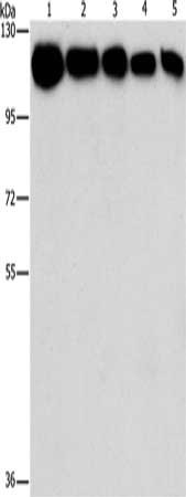 Gel: 10%SDS-PAGE, Lysate: 40 μg, Lane 1-5: A431 cells, K562 cells, 231 cells, hela cells, hepG2 cells, Primary antibody: HK2 Antibody(HK2 Antibody) at dilution 1/1200, Secondary antibody: Goat anti rabbit IgG at 1/8000 dilution, Exposure time: 1 secondRabbit anti-Human HK2 Polyclonal Antibody