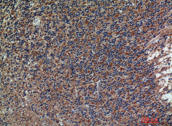 Immunohistochemical analysis of paraffin-embedded human-brain, antibody was diluted at 1:200Rabbit anti-Human NCAM1 Polyclonal Antibody