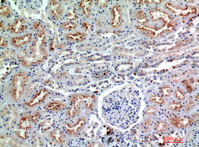 Immunohistochemical analysis of paraffin-embedded human-kidney, antibody was diluted at 1:200Rabbit anti-Human NCAM1 Polyclonal Antibody
