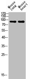 Western blot analysis of mouse-lung mouse-heart lysis using NCAM1 antibody. Antibody was diluted at 1:1000. Secondary antibody  was diluted at 1:20000Rabbit anti-Human NCAM1 Polyclonal Antibody