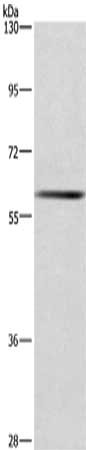 Gel: 6%SDS-PAGE, Lysate: 40 μg, Lane: Mouse liver tissue, Primary antibody: GCKR Antibody(GCKR Antibody) at dilution 1/750, Secondary antibody: Goat anti rabbit IgG at 1/8000 dilution, Exposure time: 10 secondsRabbit anti-Human GCKR Polyclonal Antibody