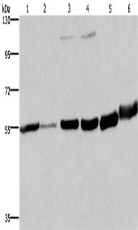 Gel: 8%SDS-PAGE, Lysate: 40 μg, Lane 1-6: Human fetal liver tissue, Human testis tissue, 293T cells, A172 cells, mouse brain tissue, human fetal brain tissue, Primary antibody: MCHR1 Antibody(MCHR1 Antibody) at dilution 1/350, Secondary antibody: Goat anti rabbit IgG at 1/8000 dilution, Exposure time: 1 minute