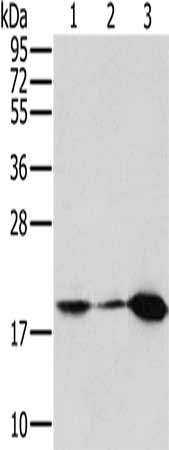 Gel: 10%SDS-PAGE, Lysate: 40 μg, Lane 1-3: Mouse kidney tissue, hela cells, mouse heart tissue, Primary antibody: MTFP1 Antibody(MTFP1 Antibody) at dilution 1/200, Secondary antibody: Goat anti rabbit IgG at 1/8000 dilution, Exposure time: 5 secondsRabbit anti-Human MTFP1 Polyclonal Antibody