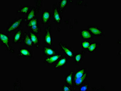 Immunofluorescent analysis of Hela cells cells using MIB1 Antibody at dilution of 1:100 and Alexa Fluor 488-congugated AffiniPure Goat Anti-Rabbit IgG(H+L)