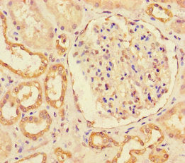 Immunohistochemistry of paraffin-embedded human kidney tissue using MIB1 Antibody at dilution of 1:100