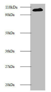 Western blot  | All lanes: MIB1 antibody at 2µg/ml + 293T whole cell lysate  | Secondary  | Goat polyclonal to rabbit IgG at 1/10000 dilution  | Predicted band size: 111 kDa  | Observed band size: 111 kDa
