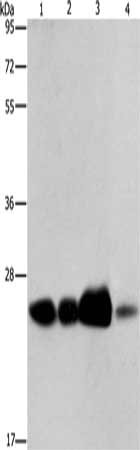 Gel: 8%SDS-PAGE, Lysate: 40 μg, Lane 1-4: 293T cells, human fetal liver tissue, human cervical cancer tissue, Human fetal muscle tissue, Primary antibody: ARFRP1 Antibody(ARFRP1 Antibody) at dilution 1/800, Secondary antibody: Goat anti rabbit IgG at 1/8000 dilution, Exposure time: 40 secondsRabbit anti-Human ARFRP1 Polyclonal Antibody