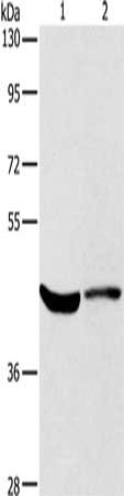 Gel: 8%SDS-PAGE, Lysate: 40 μg, Lane 1-2: Hela cells, mouse kidney tissue, Primary antibody: KCNA7 Antibody(KCNA7 Antibody) at dilution 1/550, Secondary antibody: Goat anti rabbit IgG at 1/8000 dilution, Exposure time: 40 seconds