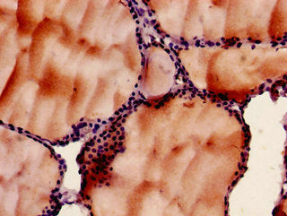 Immunohistochemistry of paraffin-embedded human thyroid tissue using the antibody at dilution of 1:100Rabbit anti-Human SLC33A1 Polyclonal Antibody