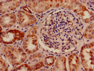 Immunohistochemistry of paraffin-embedded human kidney tissue using SLC33A1 Antibody at dilution of 1:100Rabbit anti-Human SLC33A1 Polyclonal Antibody