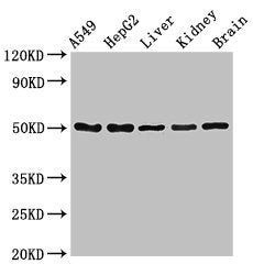 Western Blot  | Positive WB detected in: A549 whole cell lysate, HepG2 whole cell lysate, Mouse liver tissue, Mouse kidney tissue, Mouse brain tissue  | All lanes: SLC33A1 antibody at 2.5μg/ml  | Secondary  | Goat polyclonal to rabbit IgG at 1/50000 dilution  | Predicted band size: 61 kDa  | Observed band size: 50 kDaRabbit anti-Human SLC33A1 Polyclonal Antibody