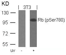 Western blot analysis of extracts from 3T3 cells untreated or treated with UV using Rb(Phospho-Ser780) Antibody.Rabbit anti-Human RB1 Polyclonal Antibody