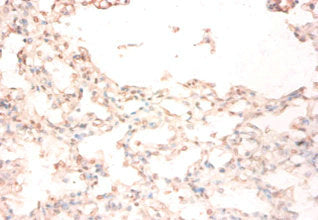 Immunohistochemistry of paraffin-embedded human lung tissue using the antibody at dilution of 1:50Rabbit anti-Human STEAP1 Polyclonal Antibody