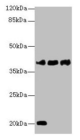 Western blot  | All lanes: STEAP1 antibody at 1µg/ml  | Lane 1: U87 whole cell lysate  | Lane 2: A431 whole cell lysate  | Lane 3: A549 whole cell lysate  | Secondary  | Goat polyclonal to rabbit IgG at 1/10000 dilution  | Predicted band size: 40 kDa  | Observed band size: 40 kDaRabbit anti-Human STEAP1 Polyclonal Antibody