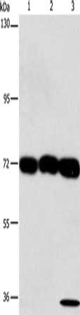 Gel: 6%SDS-PAGE, Lysate: 40 μg, Lane 1-3: 293T cells, hepG2 cells, A549 cells, Primary antibody: CKAP4 Antibody(CKAP4 Antibody) at dilution 1/1250, Secondary antibody: Goat anti rabbit IgG at 1/8000 dilution, Exposure time: 30 secondsRabbit anti-Human CKAP4 Polyclonal Antibody