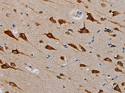 The image is immunohistochemistry of paraffin-embedded Human brain tissue using TAB3 Antibody(TAB3 Antibody) at dilution 1/25. (Original magnification: ×200)Rabbit anti-Human TAB3 Polyclonal Antibody