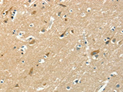The image on the left is immunohistochemistry of paraffin-embedded Human brain tissue using the antibody Antibody) at dilution 1/50, on the right is treated with fusion protein. (Original magnification: ×200)
