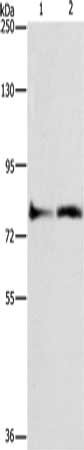 Gel: 10%SDS-PAGE, Lysate: 40 μg, Lane 1-2: Lovo cells, mouse heart tissue, Primary antibody: ASAH2 Antibody(ASAH2 Antibody) at dilution 1/270, Secondary antibody: Goat anti rabbit IgG at 1/8000 dilution, Exposure time: 40 secondsRabbit anti-Human ASAH2 Polyclonal Antibody