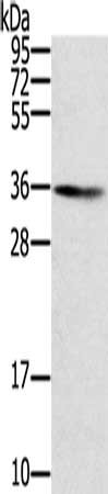 Gel: 8%SDS-PAGE, Lysate: 40 μg, Lane: Human normal liver tissue, Primary antibody: SNX11 Antibody(SNX11 Antibody) at dilution 1/300, Secondary antibody: Goat anti rabbit IgG at 1/8000 dilution, Exposure time: 5 minutesRabbit anti-Human SNX11 Polyclonal Antibody