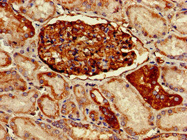Immunohistochemistry of paraffin-embedded human kidney tissue using PODXL Antibody at dilution of 1:100Rabbit anti-Human PODXL Polyclonal Antibody
