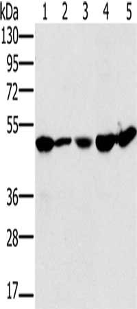 Gel: 8%SDS-PAGE, Lysate: 40 μg, Lane 1-5: 231 cells, Jurkat cells, mouse liver tissue, 293T cells, hela cells, Primary antibody: PSMC2 Antibody(PSMC2 Antibody) at dilution 1/400, Secondary antibody: Goat anti rabbit IgG at 1/8000 dilution, Exposure time: 5 secondsRabbit anti-Human PSMC2 Polyclonal Antibody