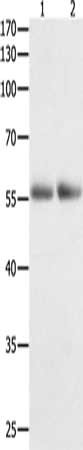 Gel: 10%SDS-PAGE, Lysate: 40 μg, Lane 1-2: Human colon tissue, Human kidney cancer tissue, Primary antibody: HDAC1 Antibody(HDAC1 Antibody) at dilution 1/400, Secondary antibody: Goat anti rabbit IgG at 1/8000 dilution, Exposure time: 2 minutesRabbit anti-Human HDAC1 Polyclonal Antibody